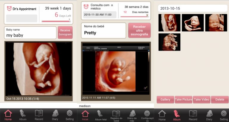 ‘Samsung’ – Empresa lança aplicativo que compartilha imagens do ultrassom do bebê